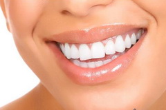 Идеальная улыбка: виниры для зубов 